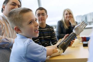 Child with prosthetic arm. Photo credit Ohsu.edu / Kristyna Wentz-Graff