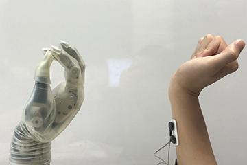 A prosthetic hand mimicing the movement of a real hand. Image credit NC State Unviersity News.