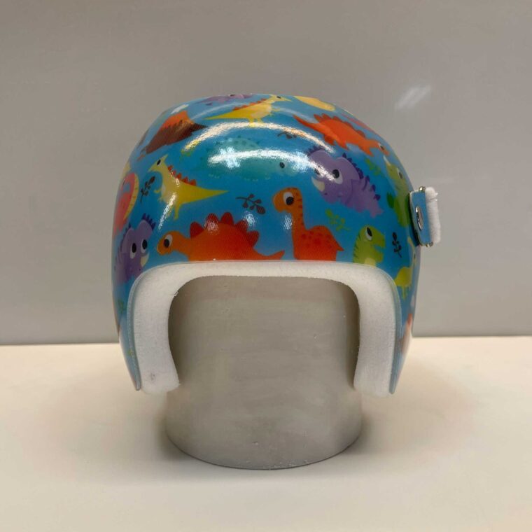 colourful-cranial-remolding-helmet-front-1