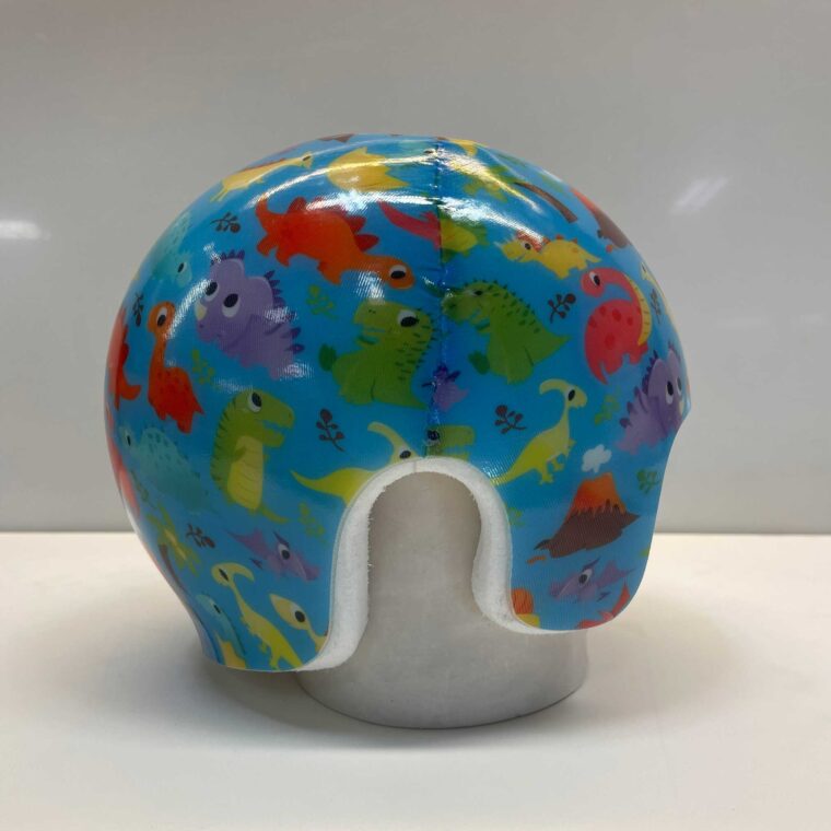 colourful-cranial-remolding-helmet-side-1
