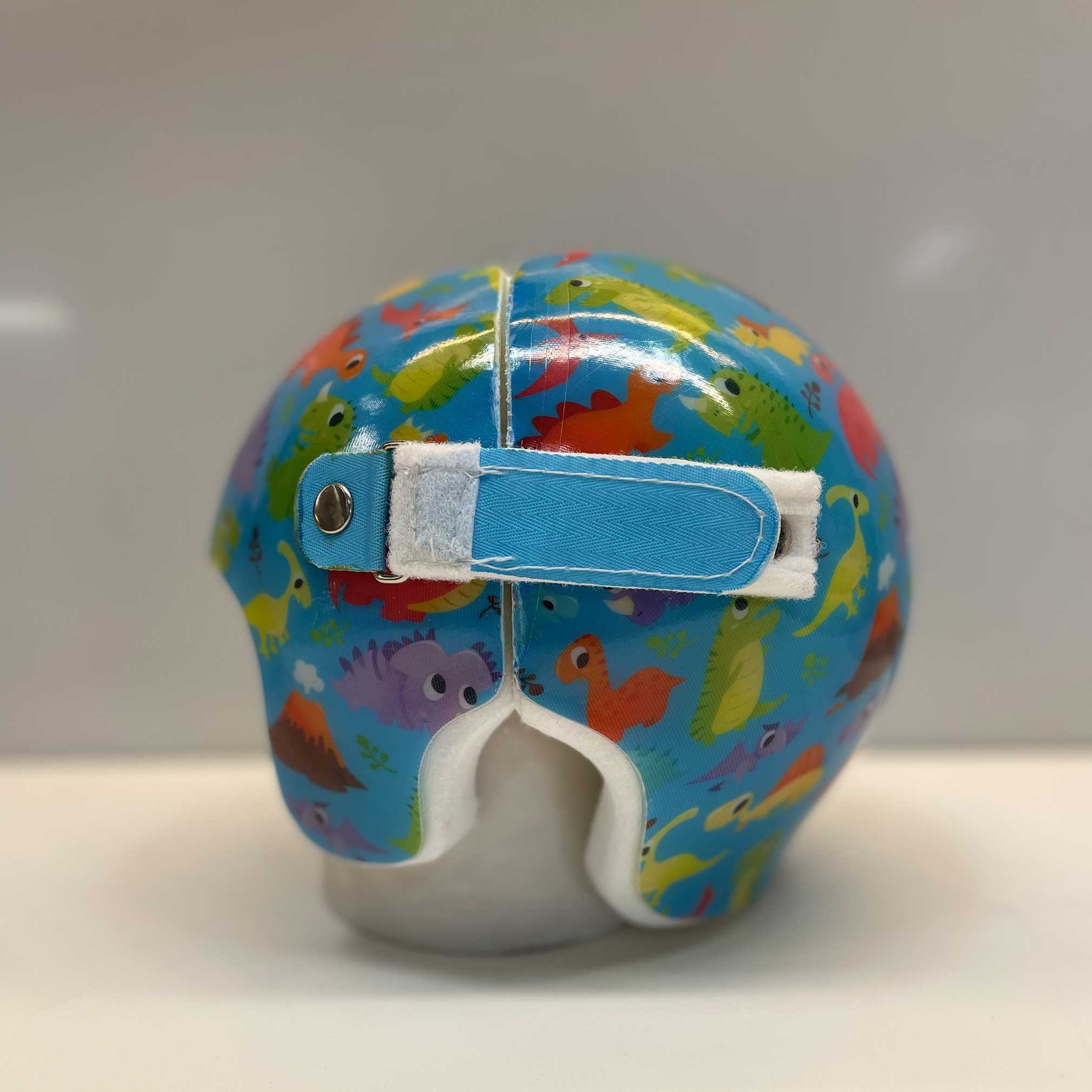 cranial remolding helmet side 2